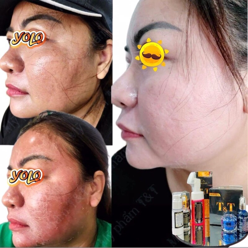 ba bộ kem face T&T